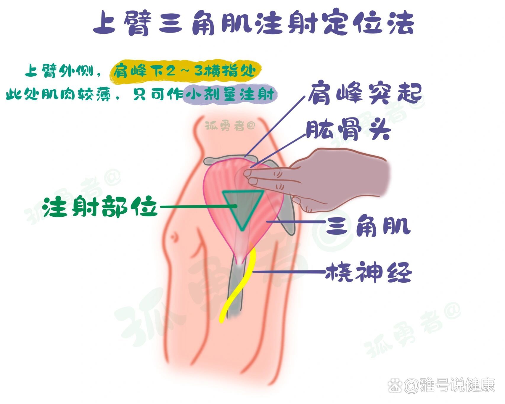 肌注定位法图片及定位图片