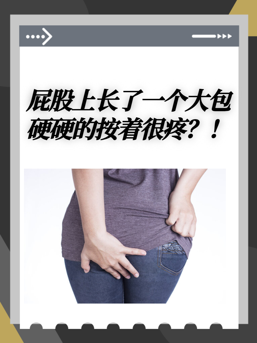 屁股上长了一个大包硬硬的按着很疼