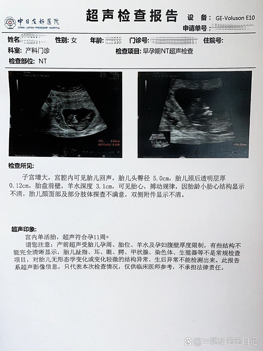 头臀径12周图片