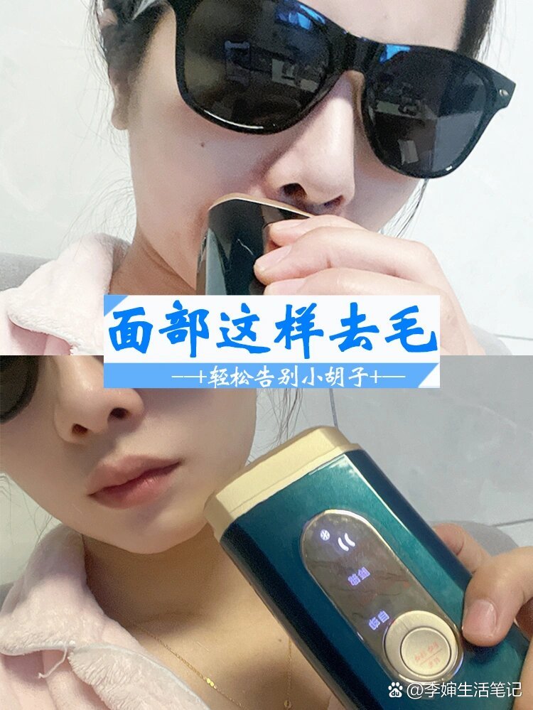 如果脸上有一些难看的唇毛的话,那真的是会影响颜值