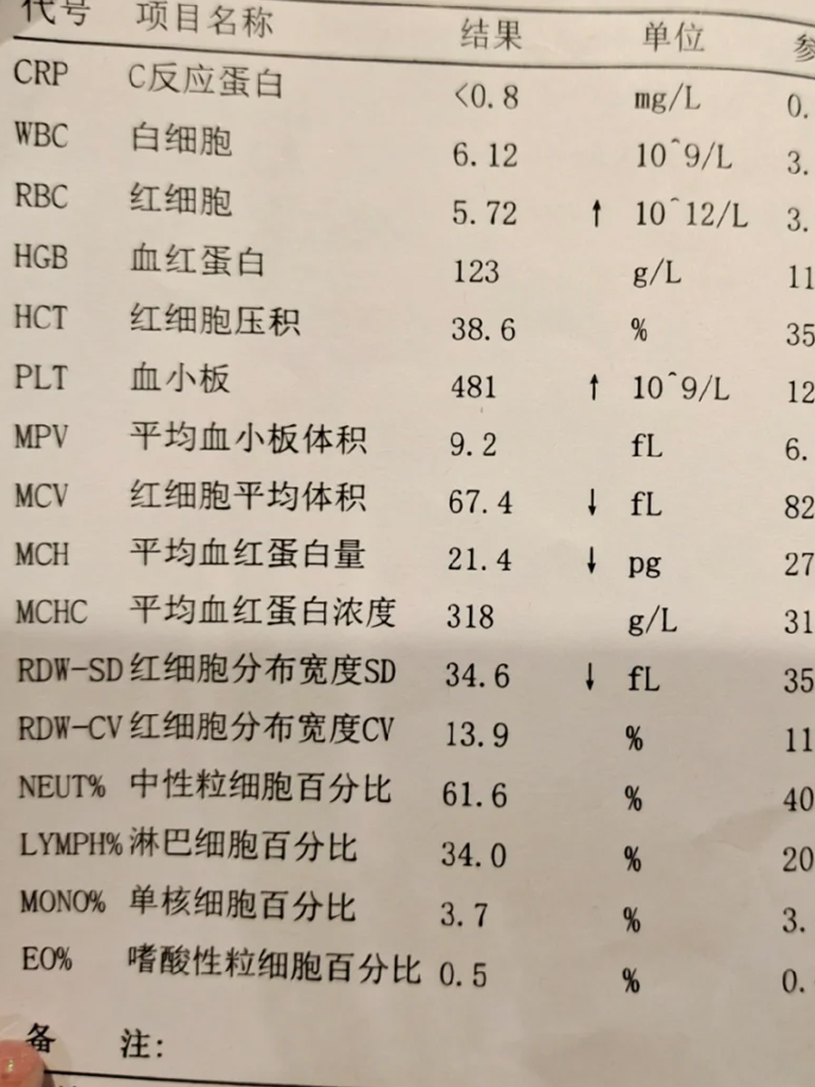 红细胞分布宽度偏低是啥意思,问了医生我才知道