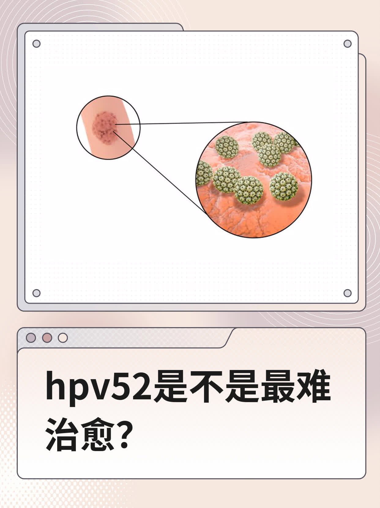 女人感染hpv52图片图片