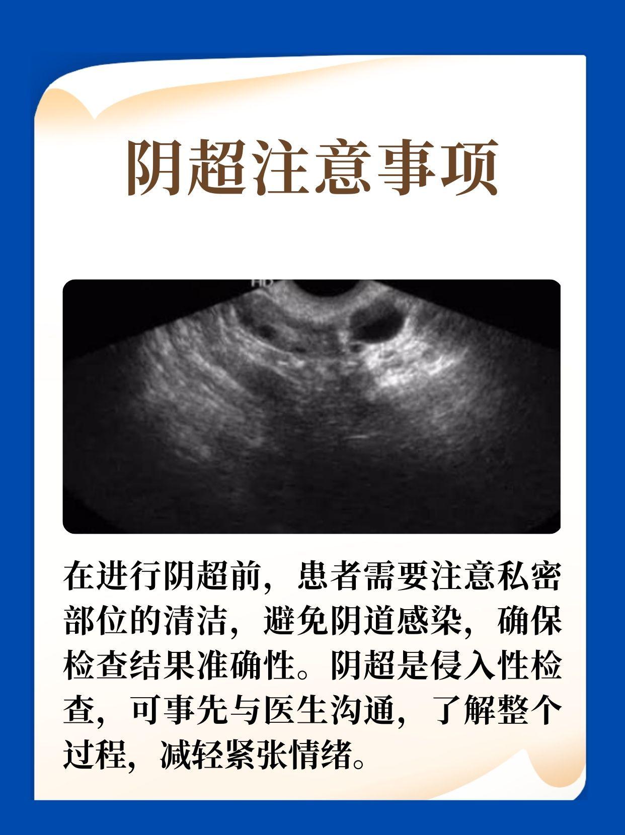 阴超与b超之间不得不说的区别,全方位解读助你做出明智选择