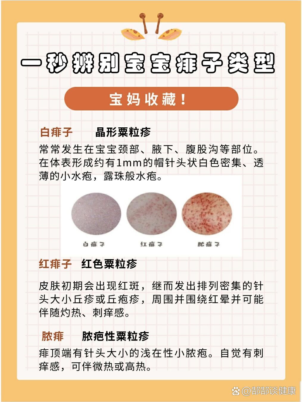教你一招,一秒辨别宝宝的痱子类型7815
