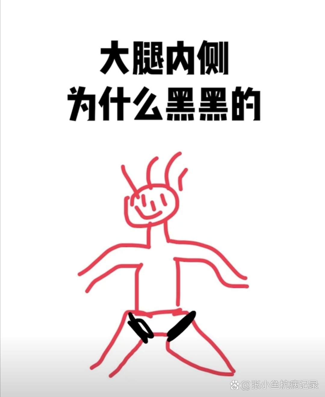 大腿内侧黑黑的