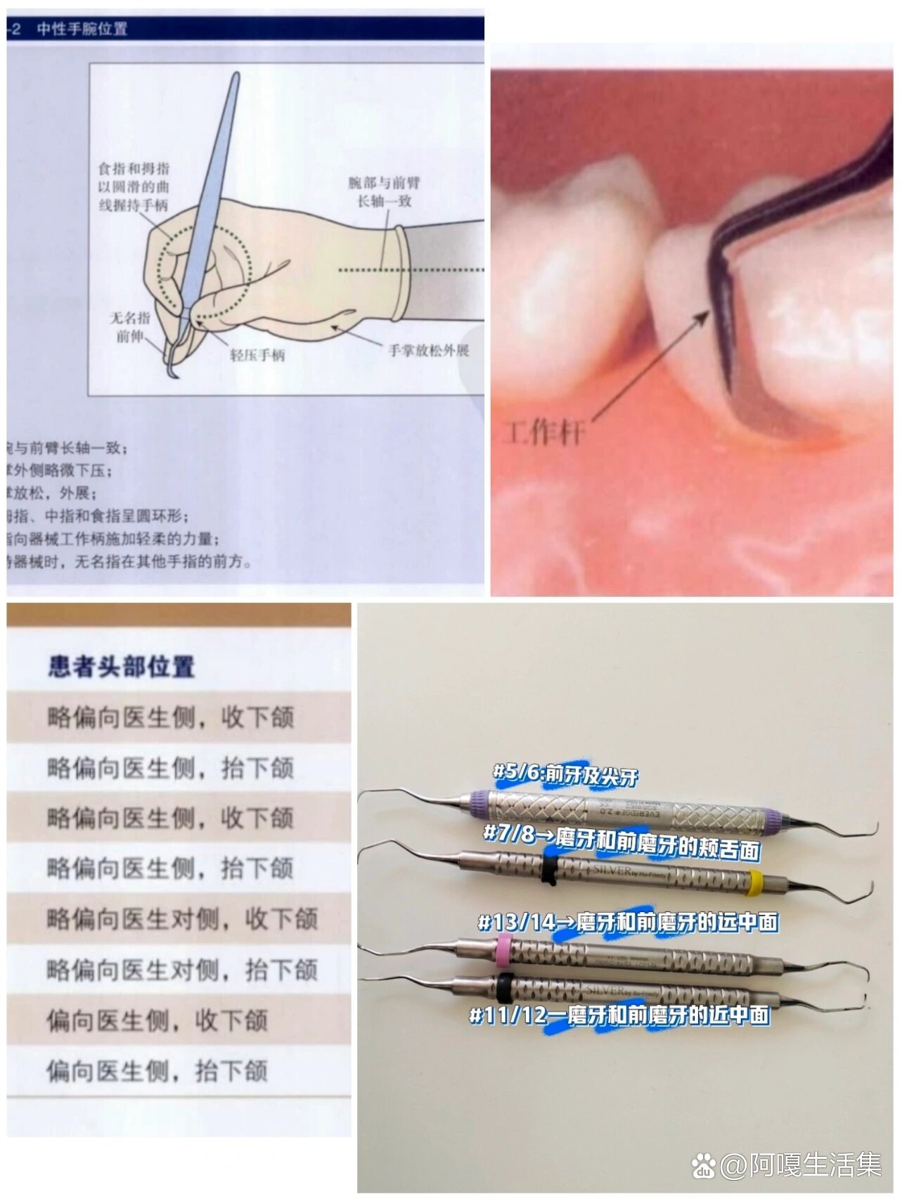 刮治器械辨认图片