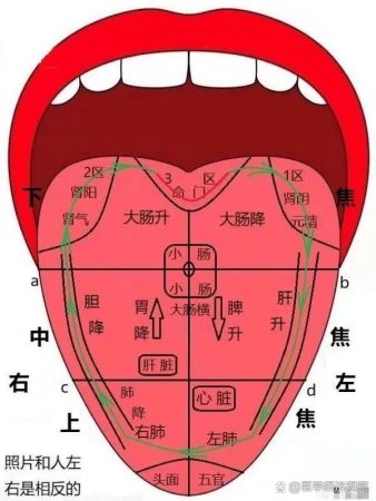 全息舌诊定位图,中医望诊提前预防