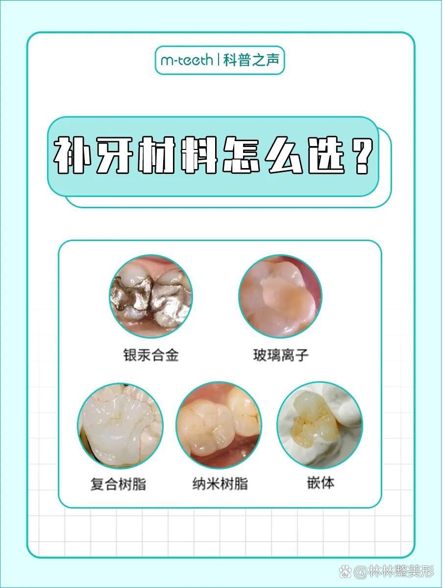 br>补牙材料选对不选贵,不同树脂有什么区别?