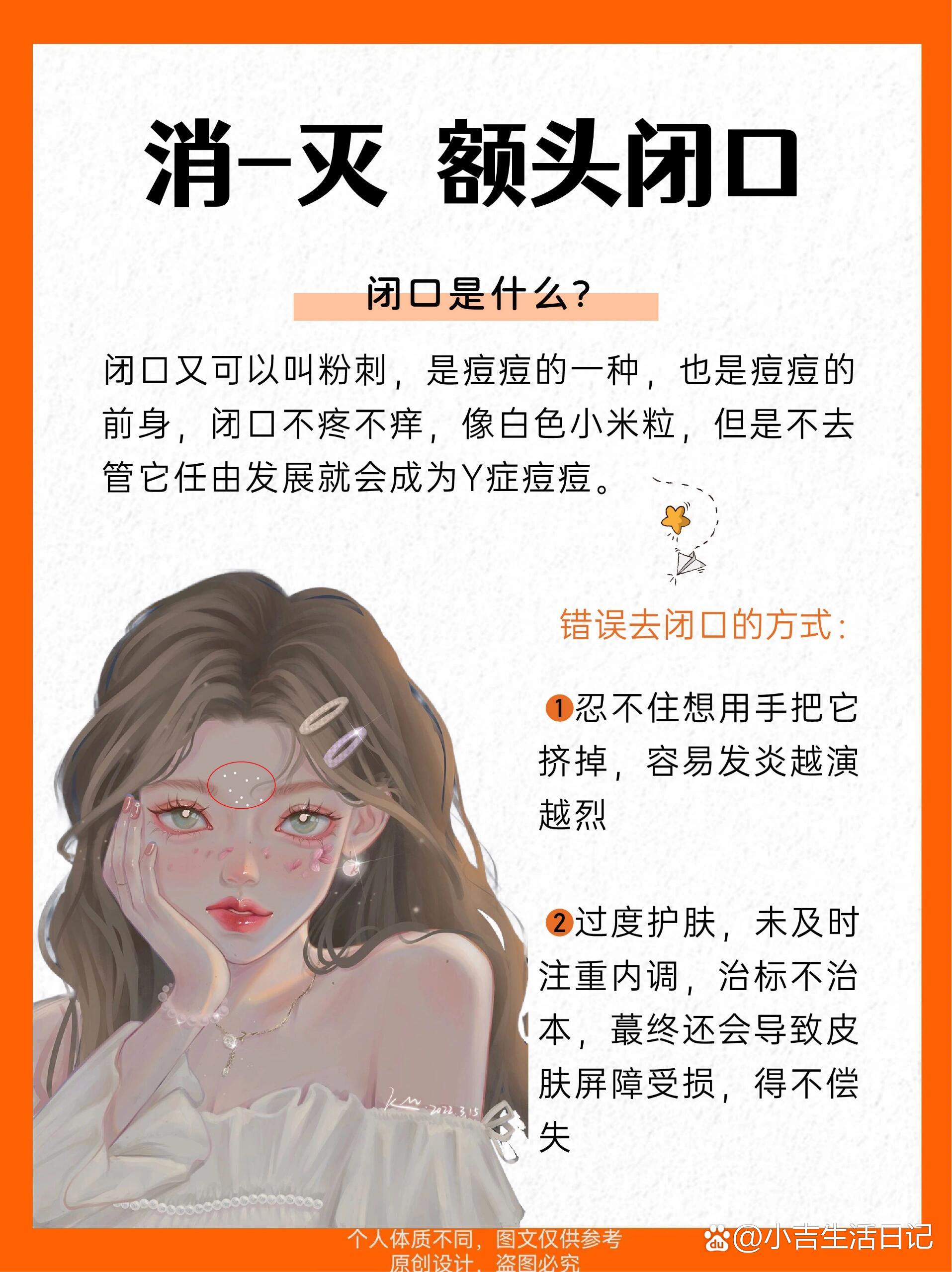 闭口粉刺恢复过程图图片