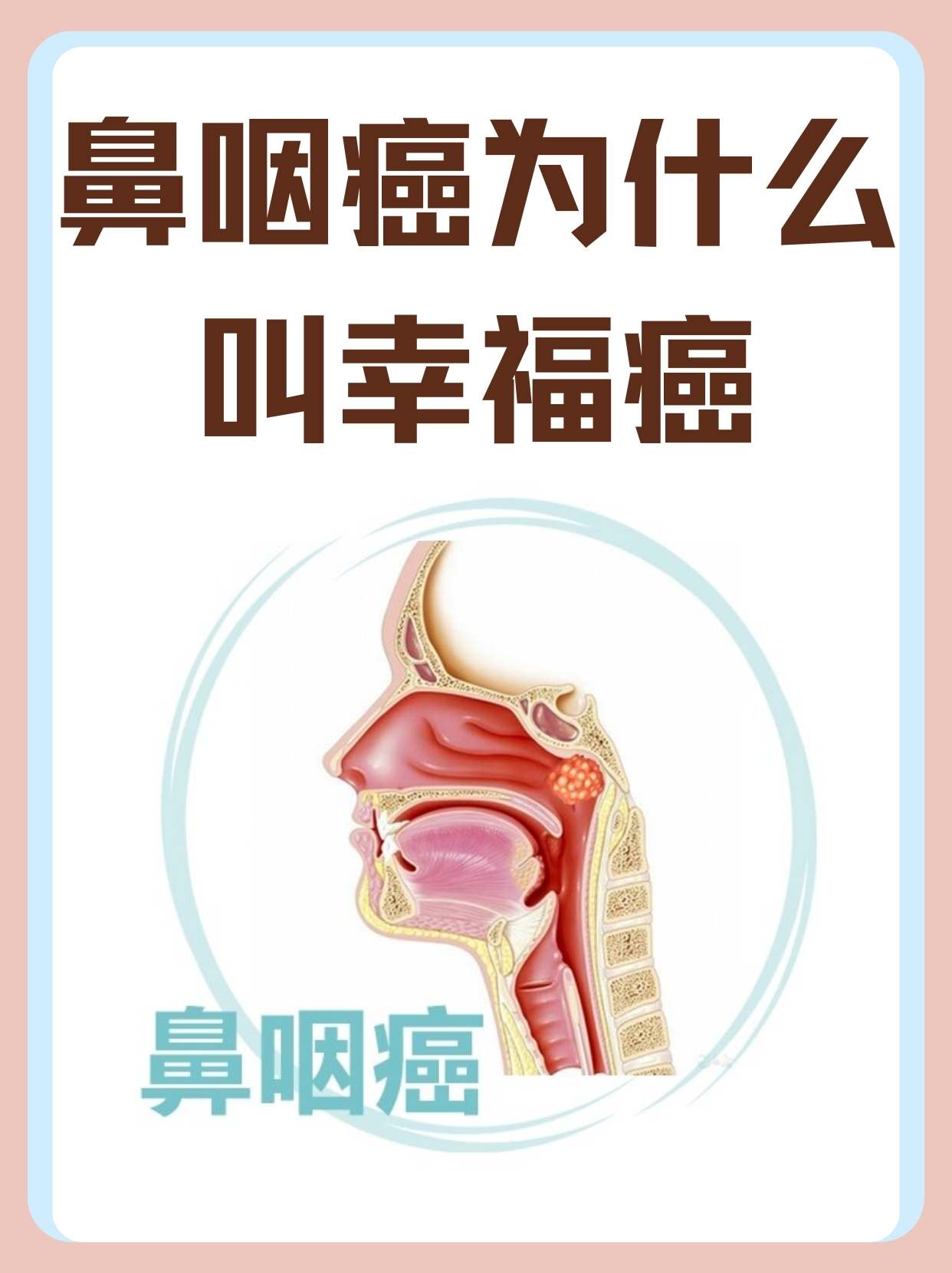 鼻咽癌:为何称为幸福癌?