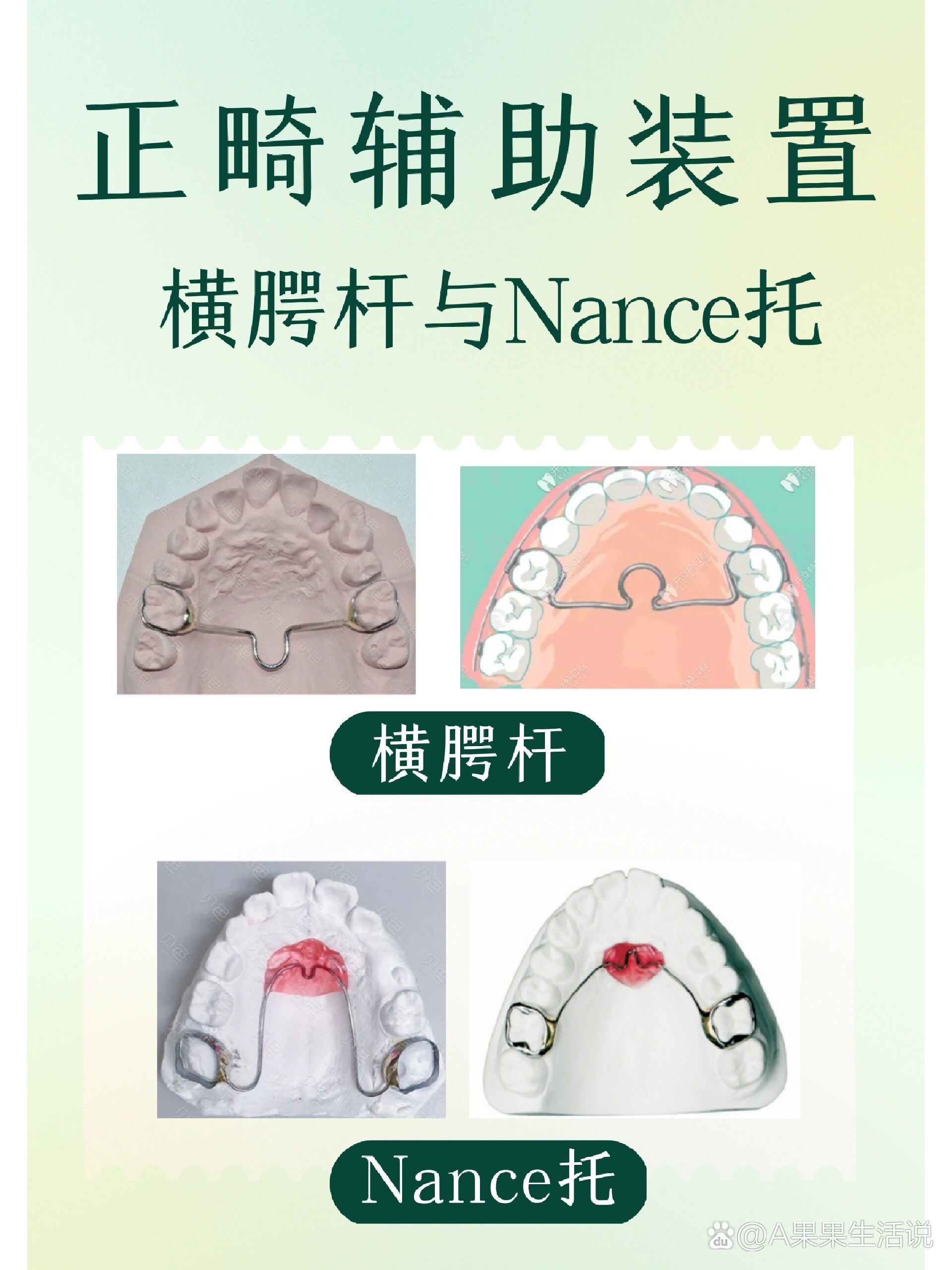 nance弓和横腭杆图片图片