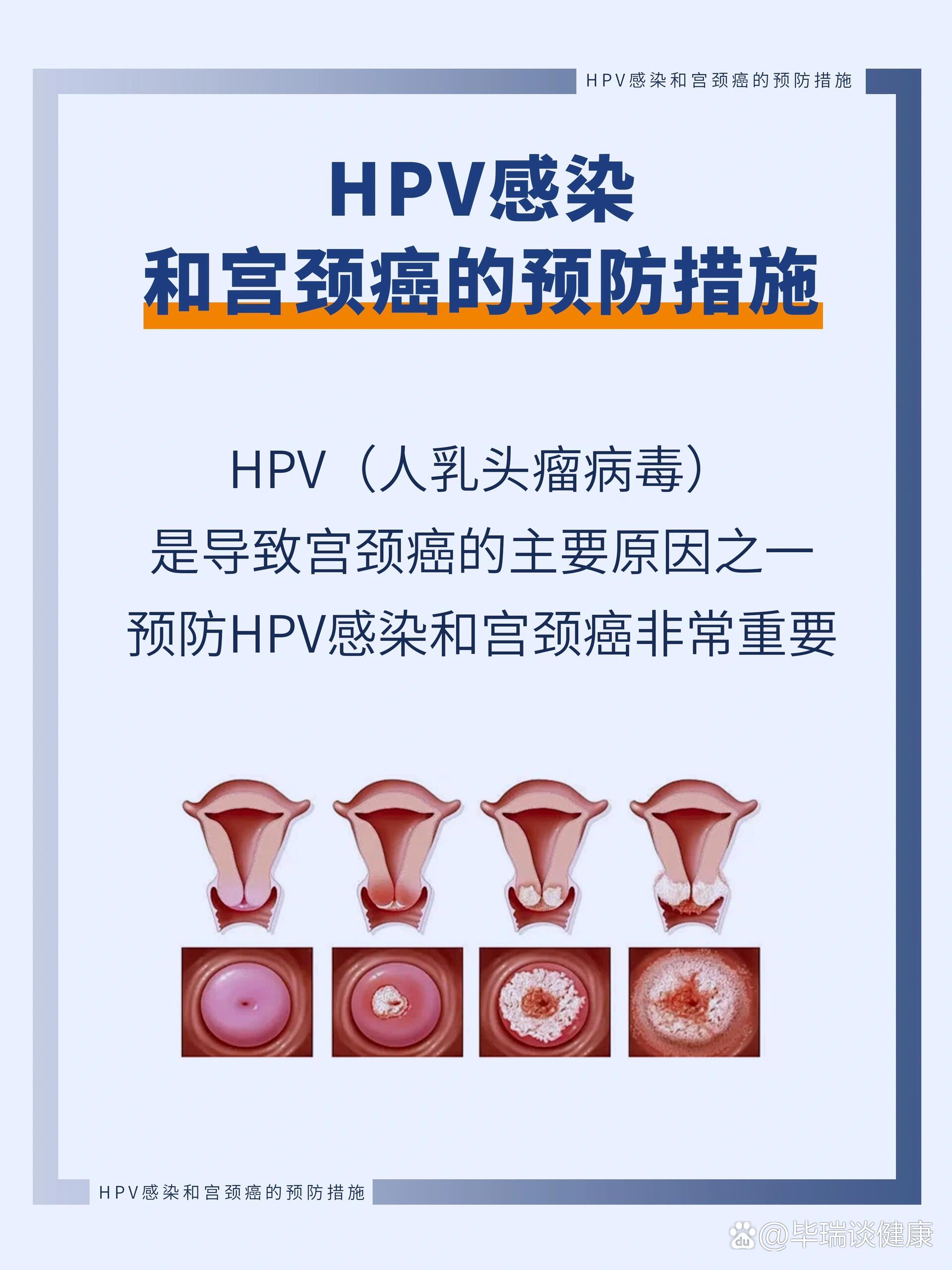 hpv感染和宫颈癌的预防措施