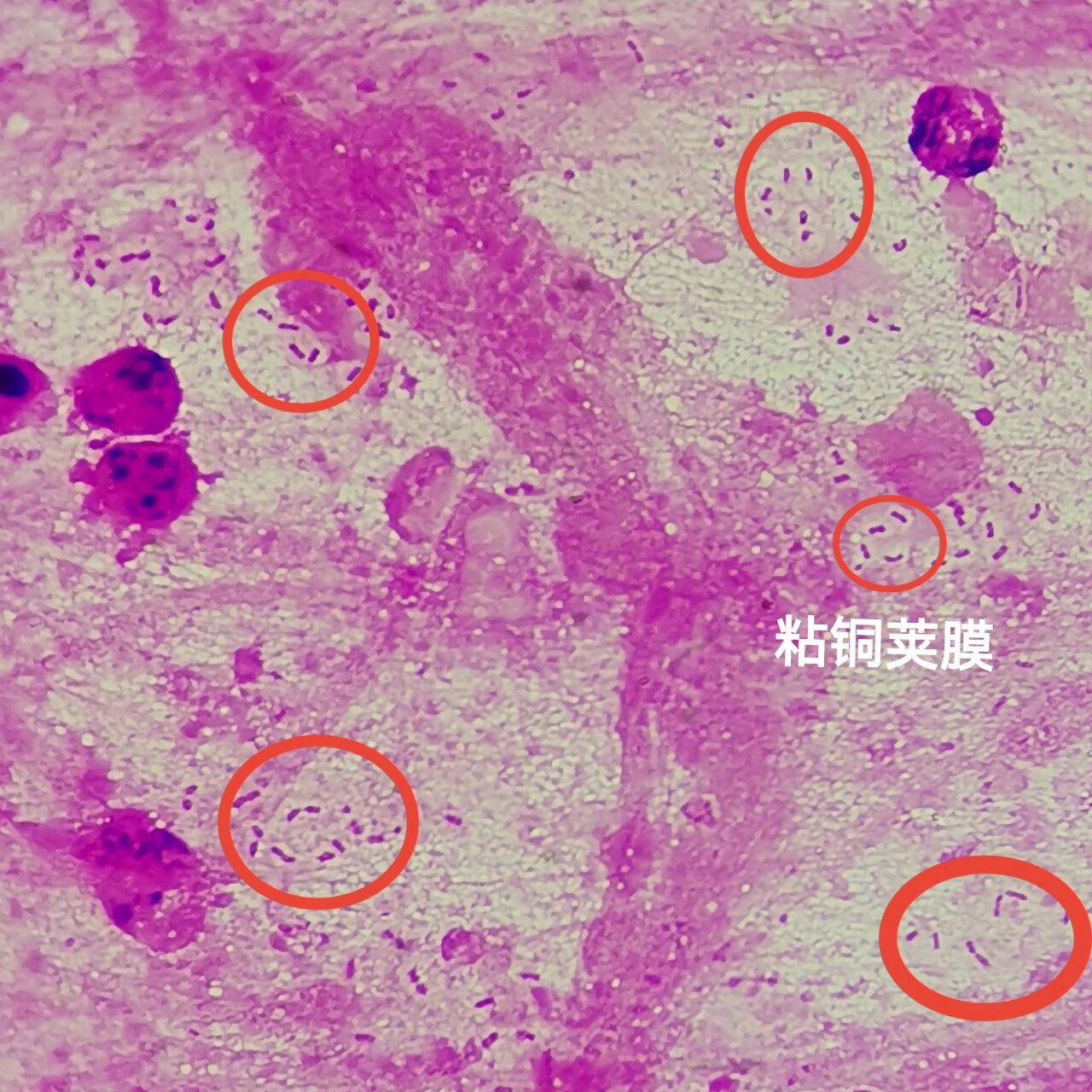 铜绿假单胞菌致病力图片