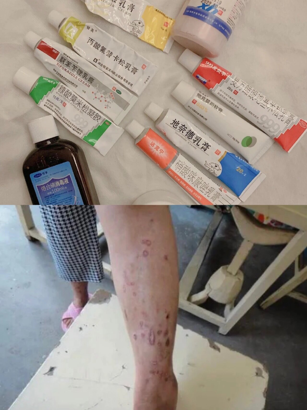 长时间使用药膏的副作用