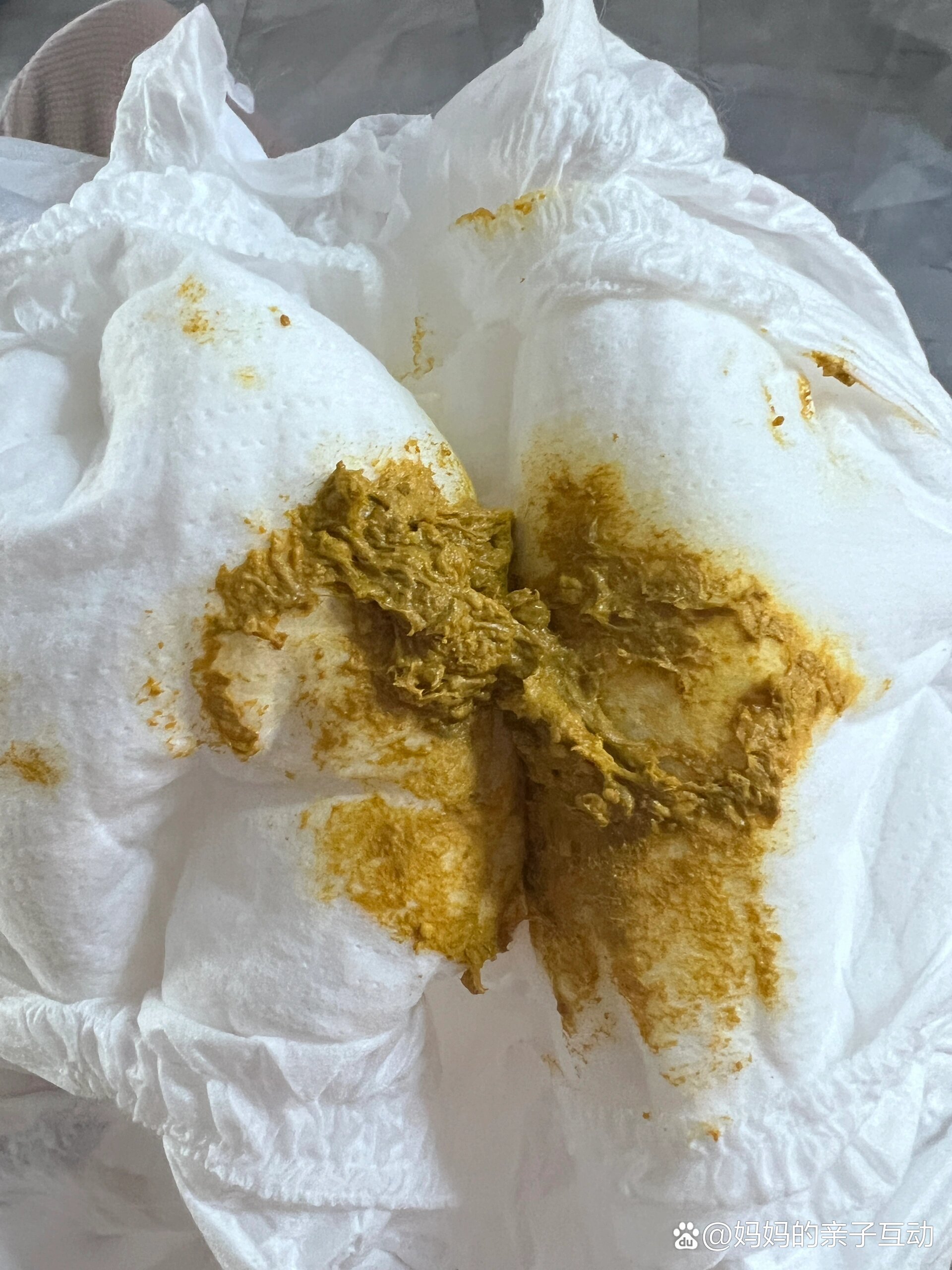 三个半月宝宝大便粘稠是正常的吗?