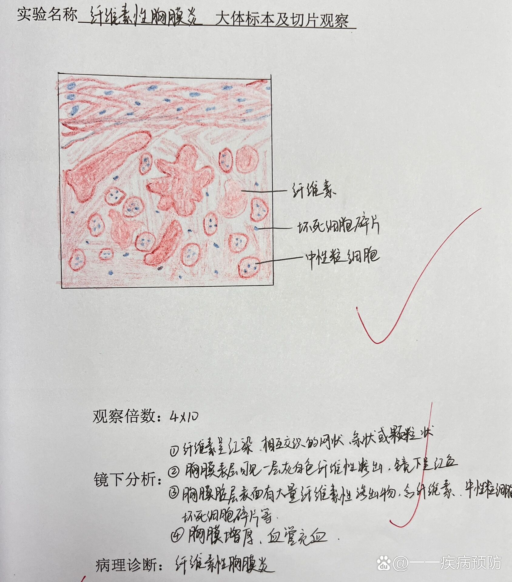 纤维细胞红蓝铅笔图图片