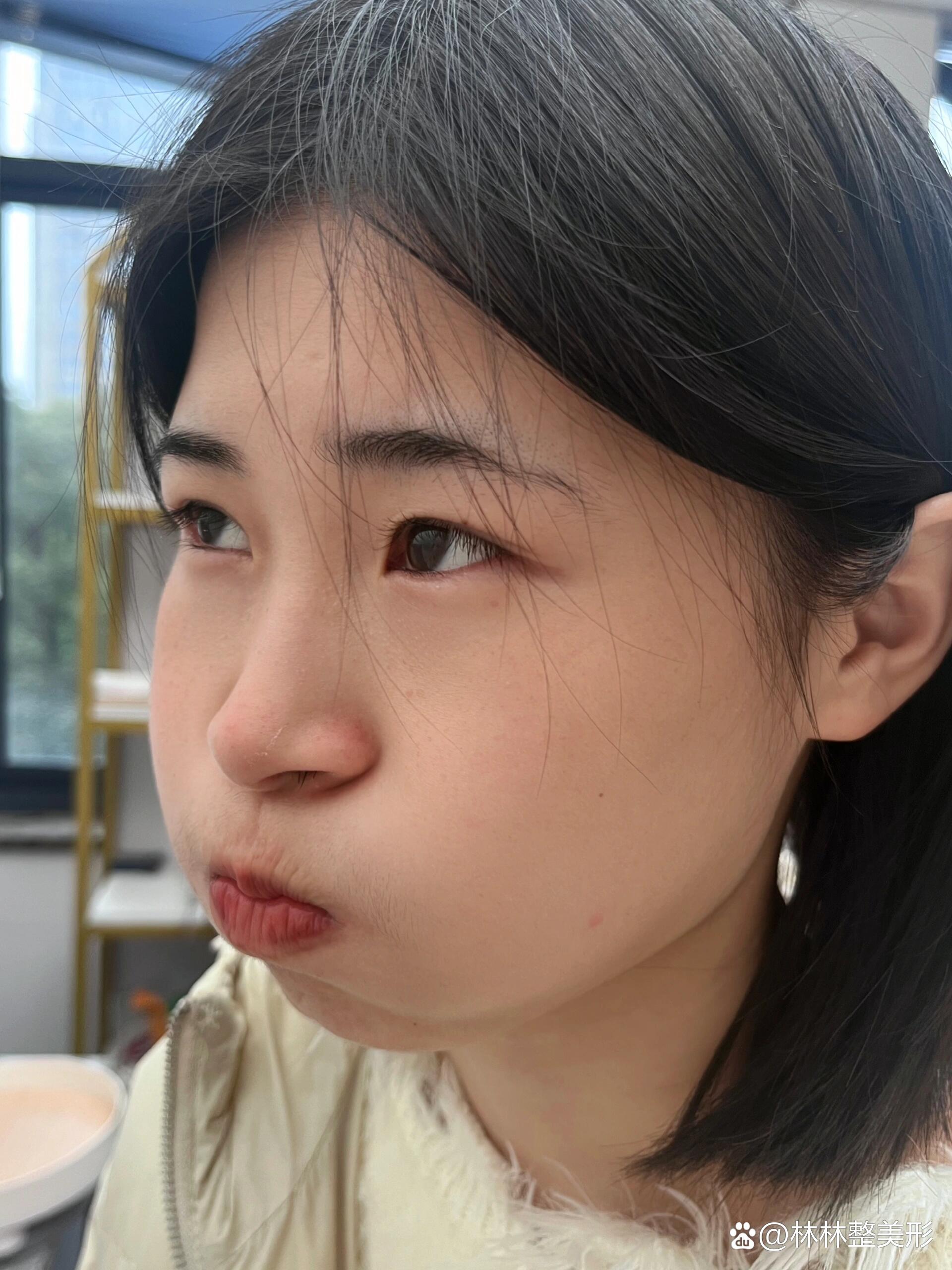 申请专利|吹气改善法令纹面部瑜伽
