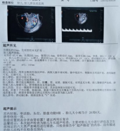 前置胎盘+前置血管