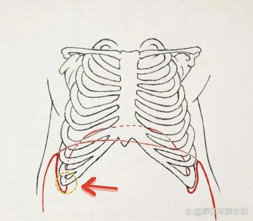 肋膈角位置图图片
