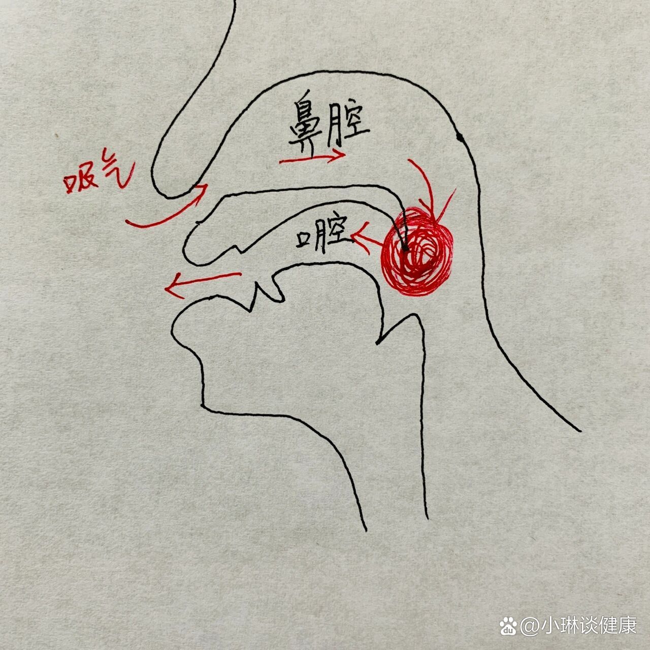 痰鸣音是什么声音 全网资源