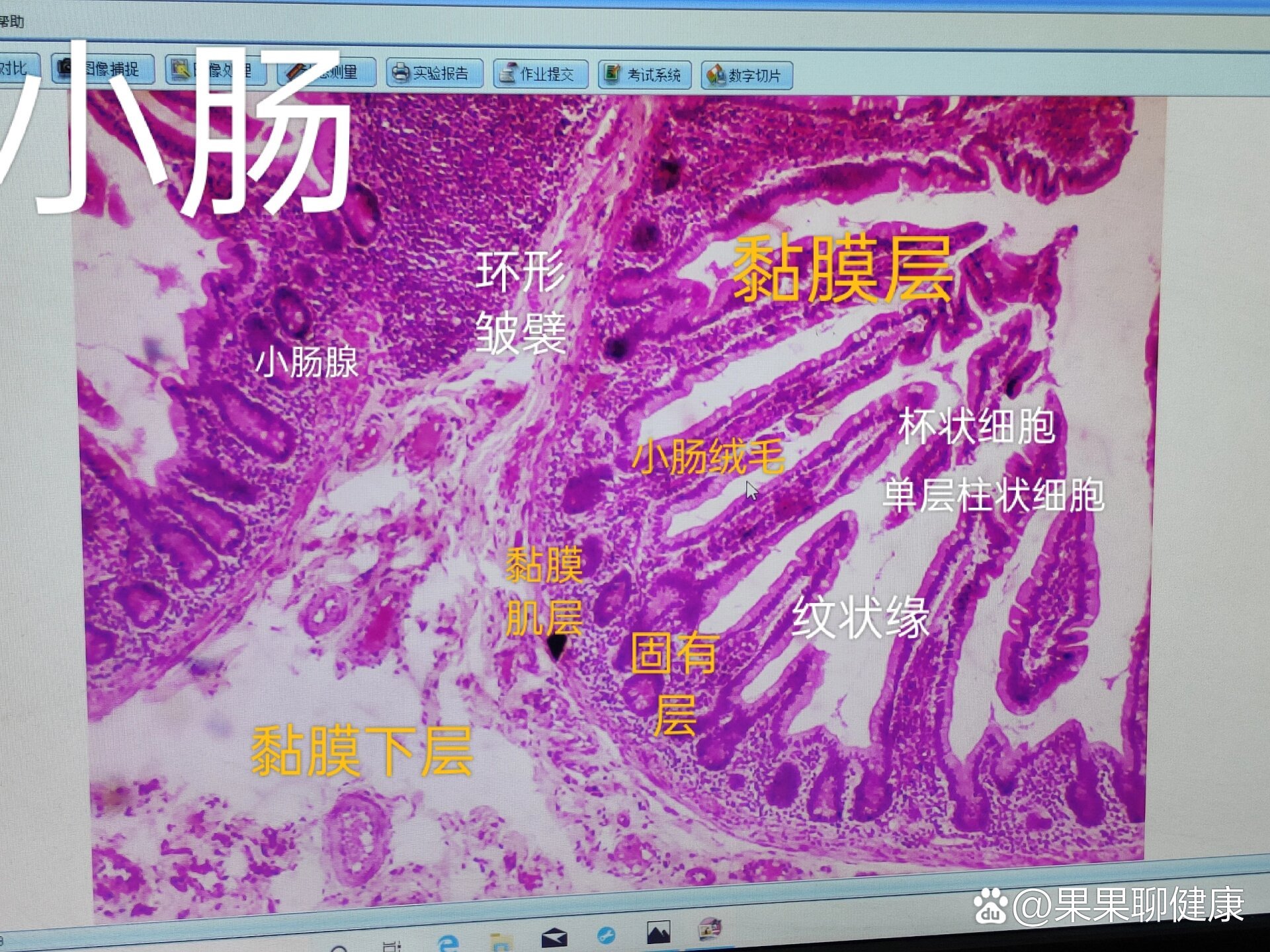 单层柱状上皮游离面图片