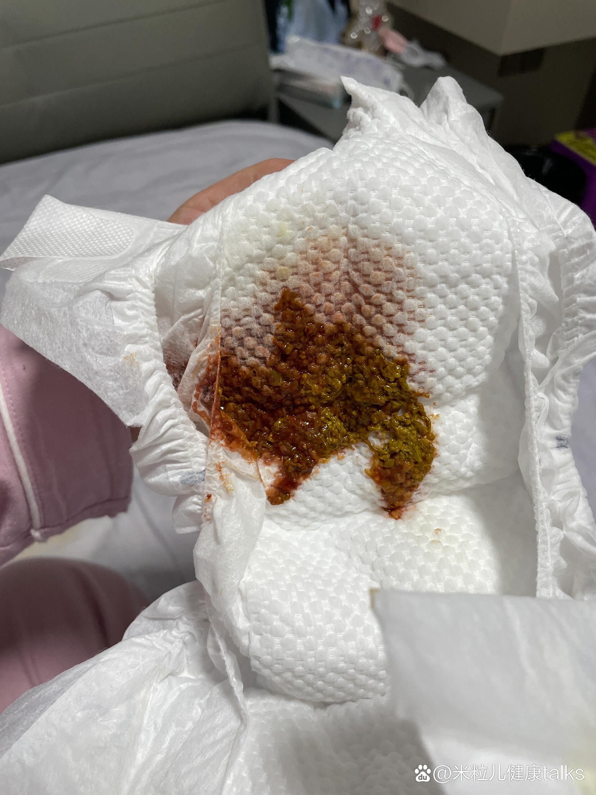 今天30天,突然出现这种果酱色粑粑,不清楚是不是血色大便