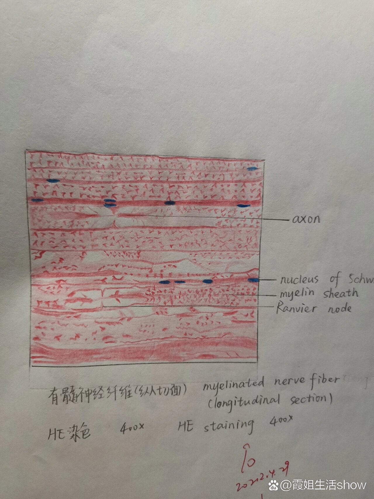 神经纤维束切片图片