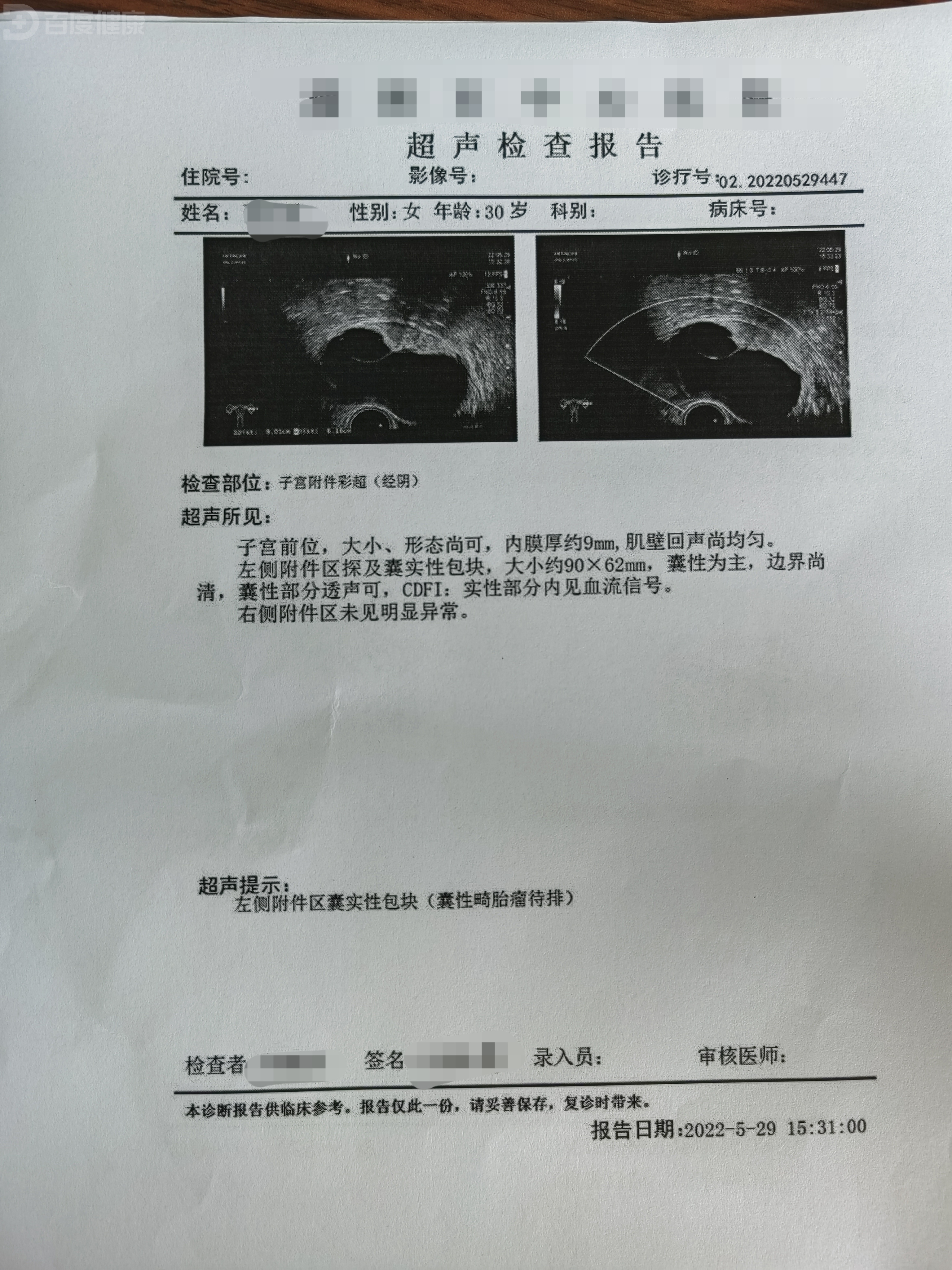 一例卵巢肿瘤患者的治疗体会