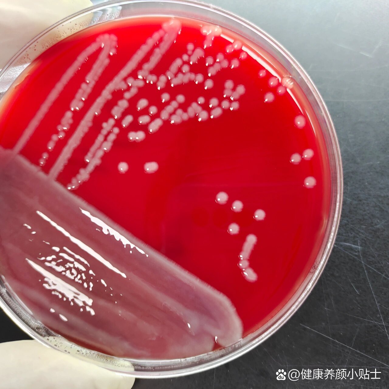 肺炎克雷伯菌 全网资源