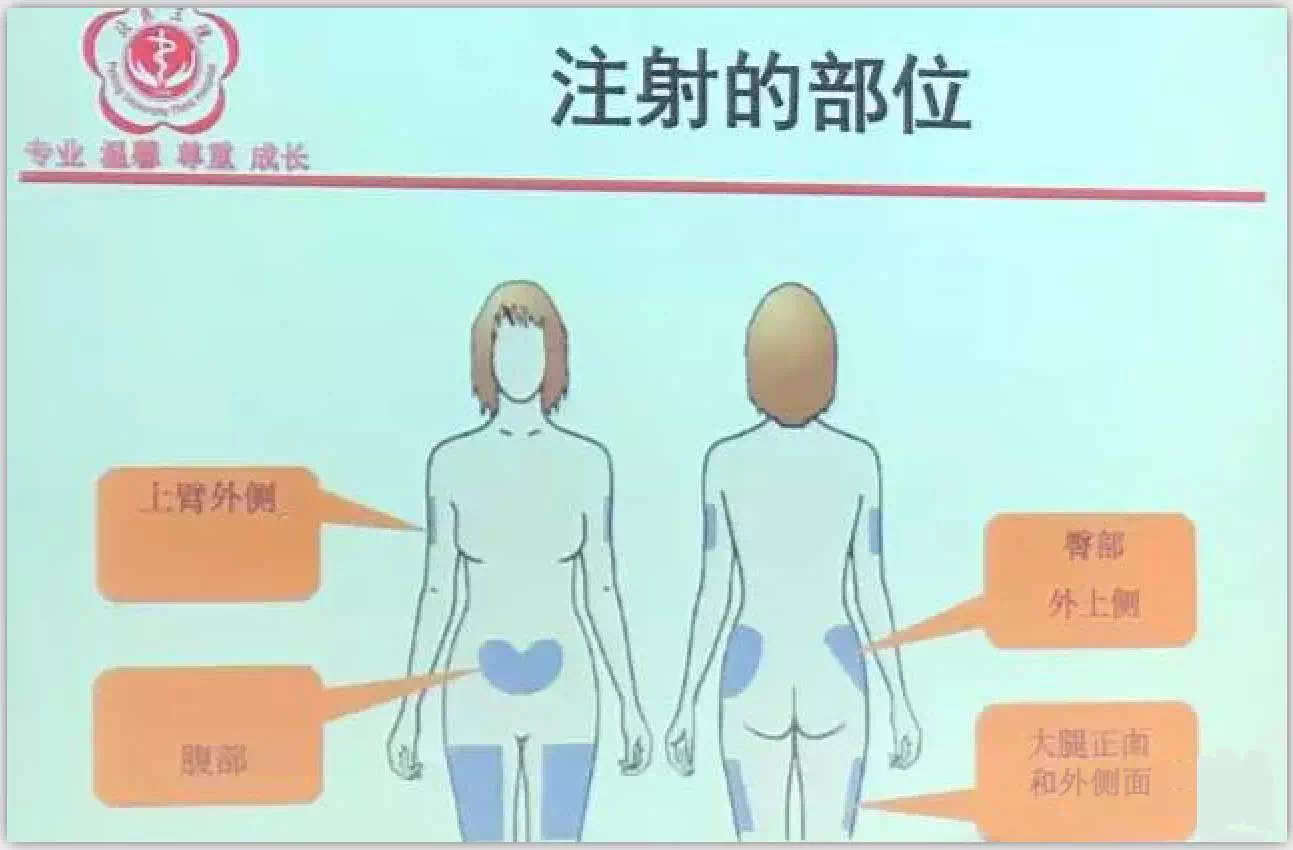 怀孕为什么要打肝素