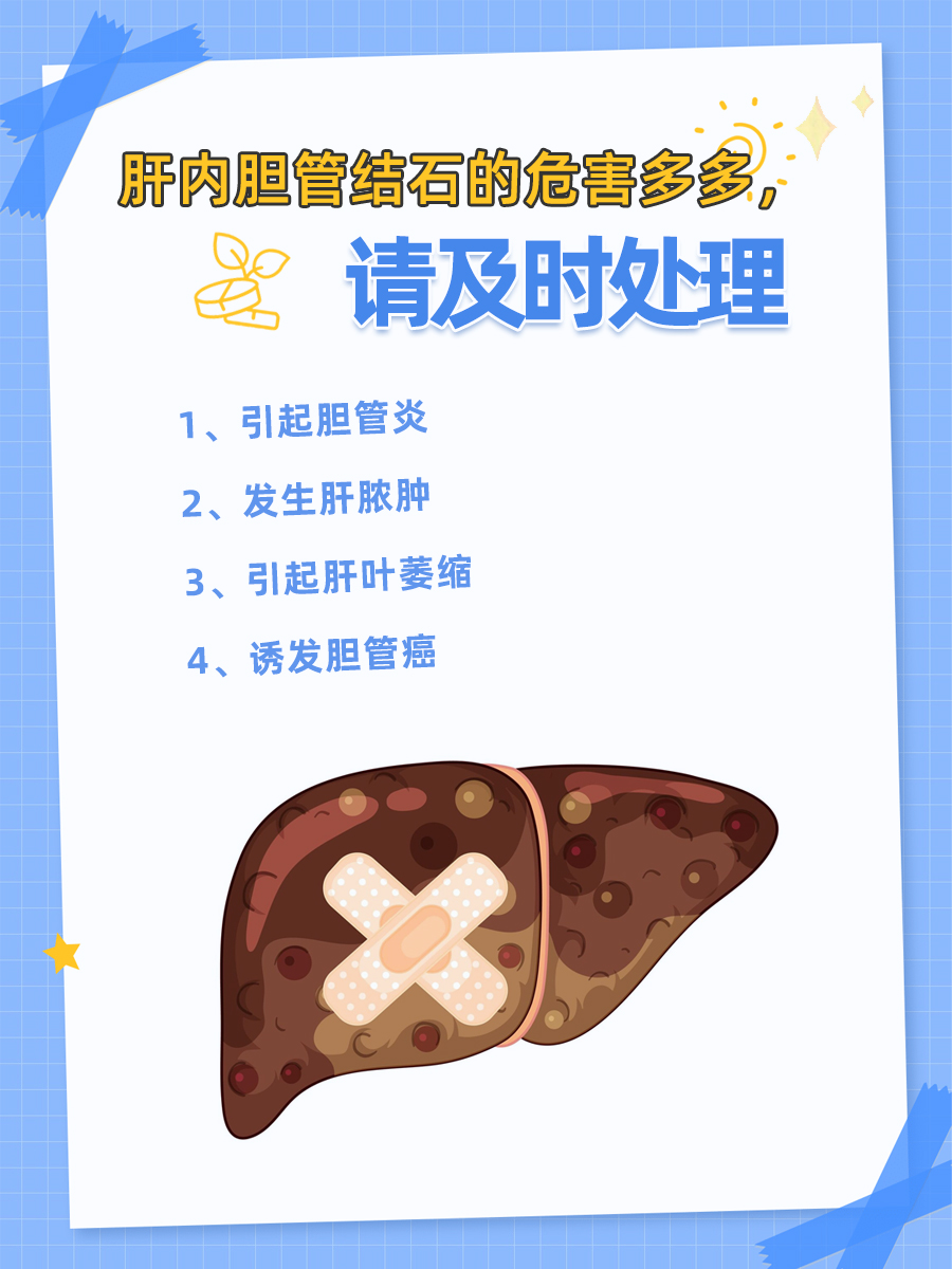 肝内胆管结石危害大,教你如何应对!