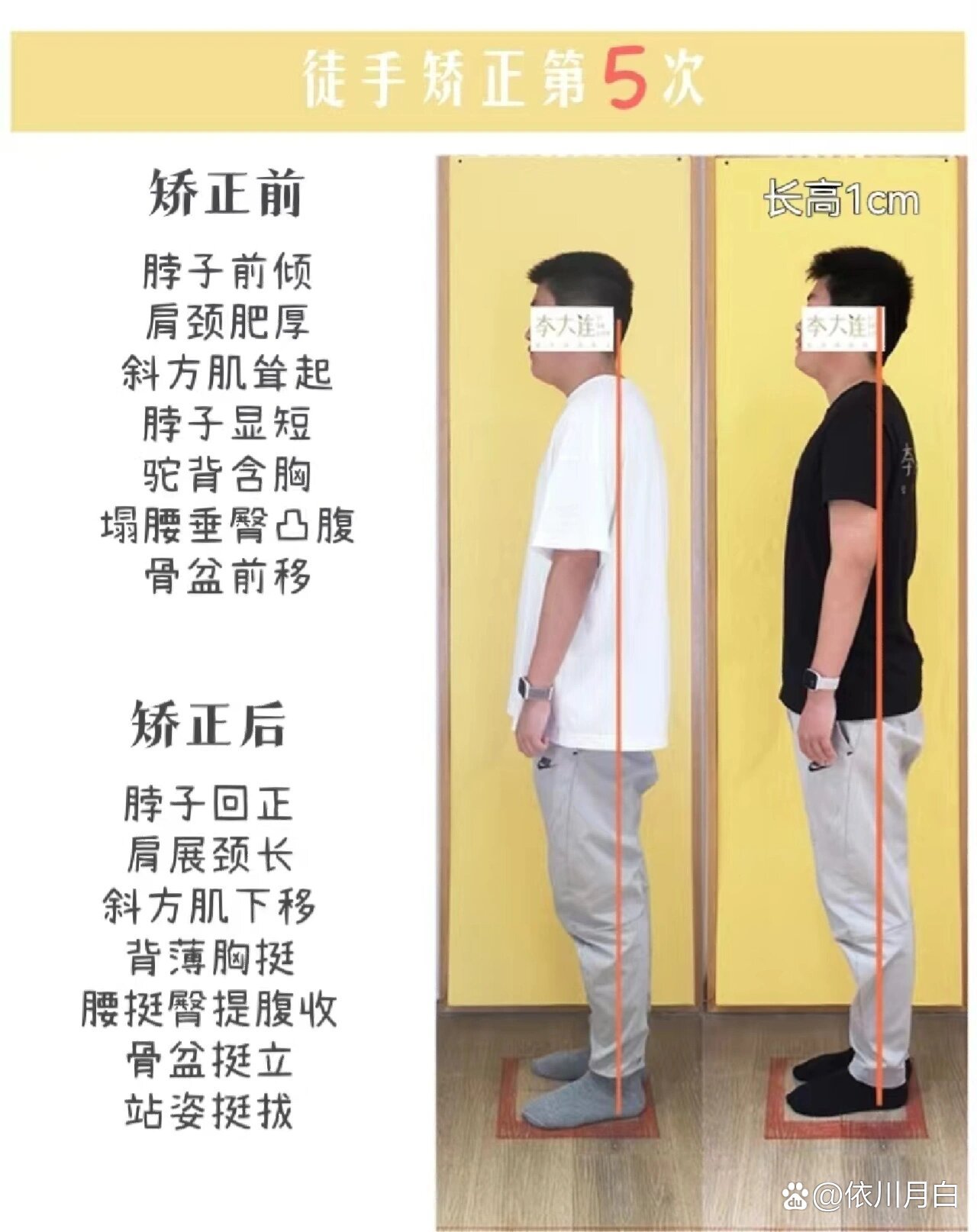 长高光长胖,身高比同学矮,马上15岁了,希望通过驼背矫正能再长高一点
