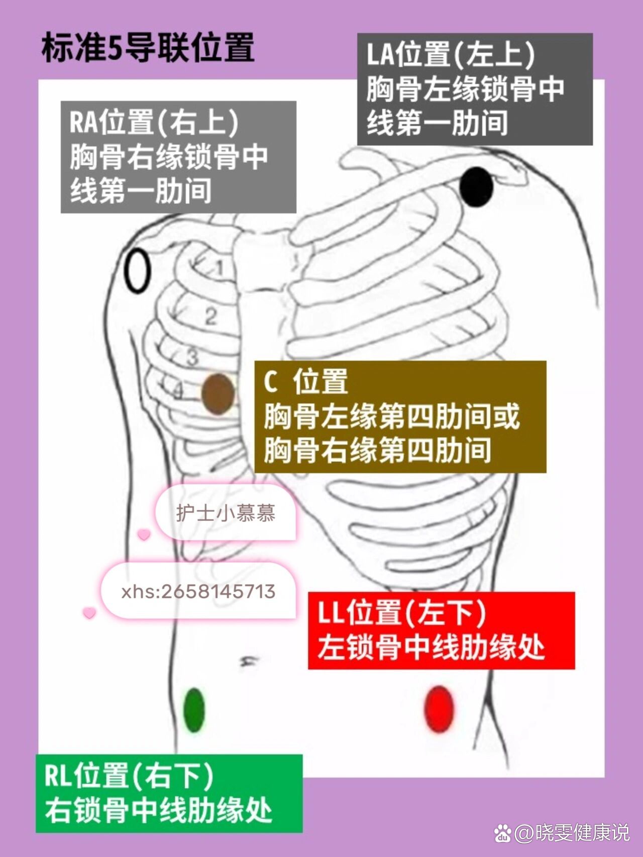 心电监护仪位置图图片