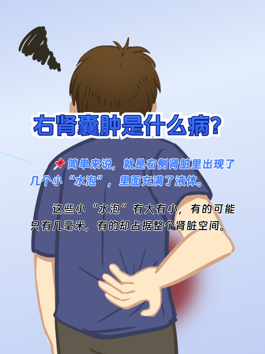 男性右肾囊肿揭秘:这是什么病,究竟有多严重?