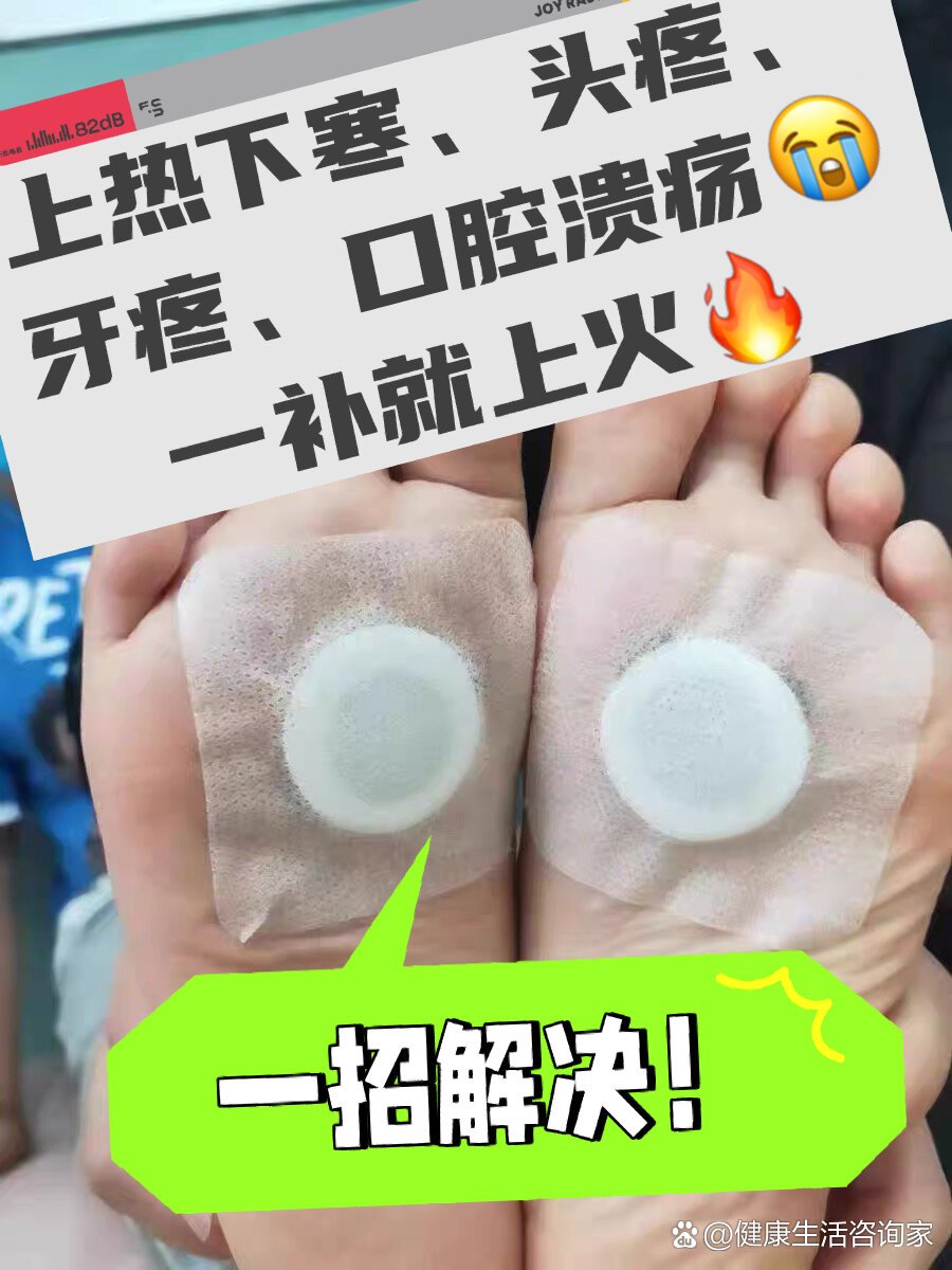 口疮贴怎么用教程图片