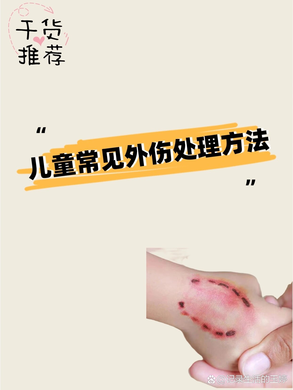 6015速速get‖儿童常见外伤处理方法