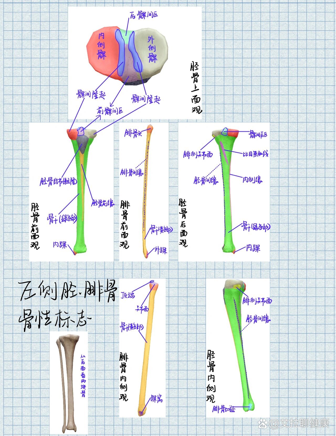 膝关节之髌骨