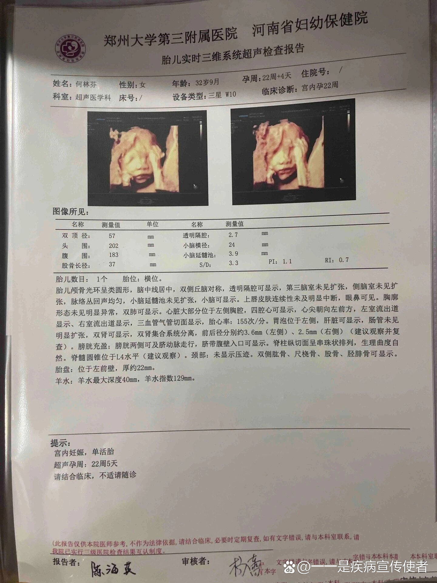 脊髓圆锥低位不要担心,相信宝宝