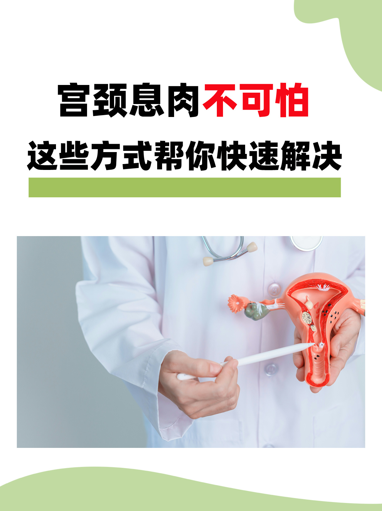 宫颈息肉不可怕,这些方式帮你快速解决