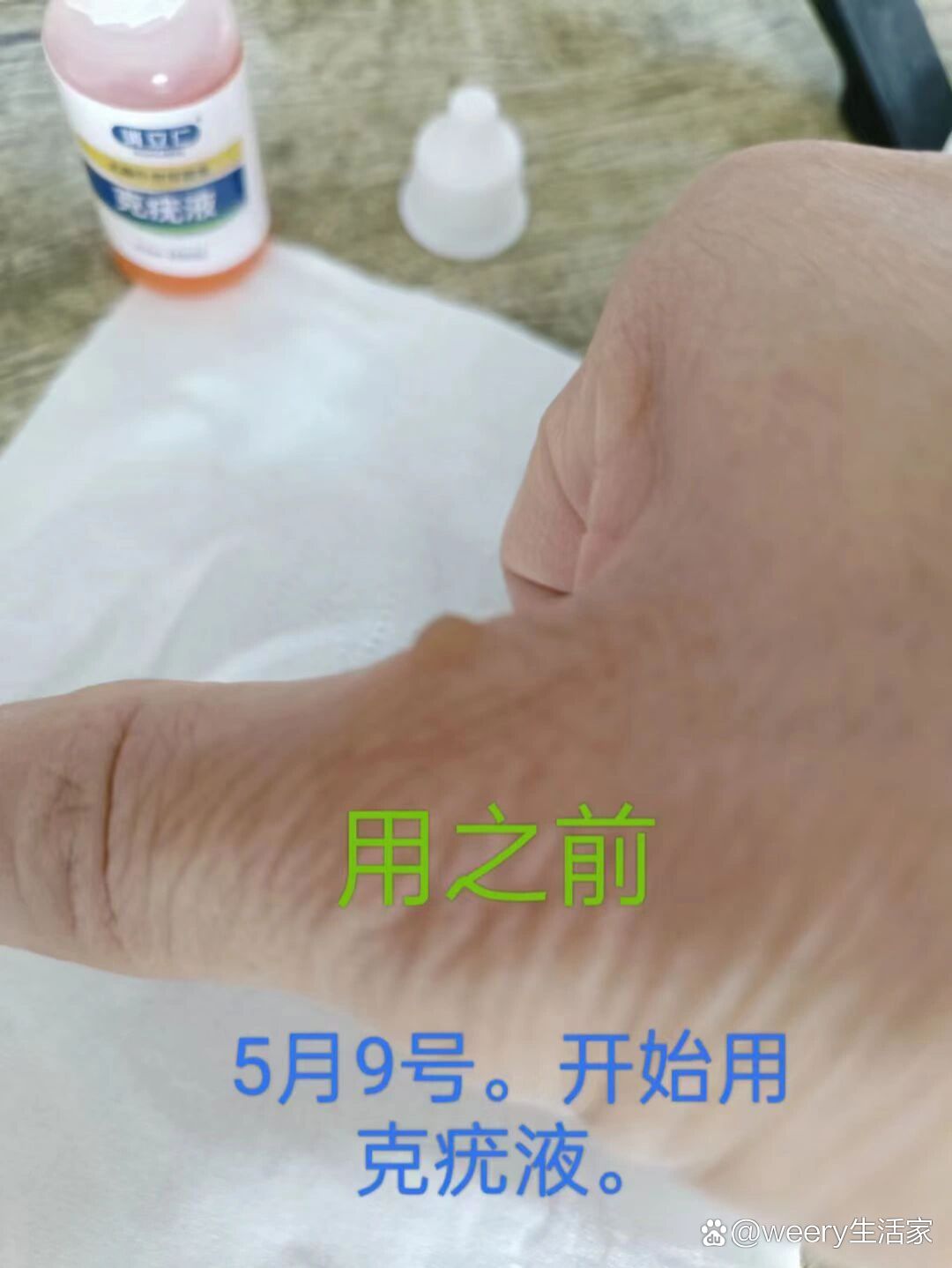 克疣液