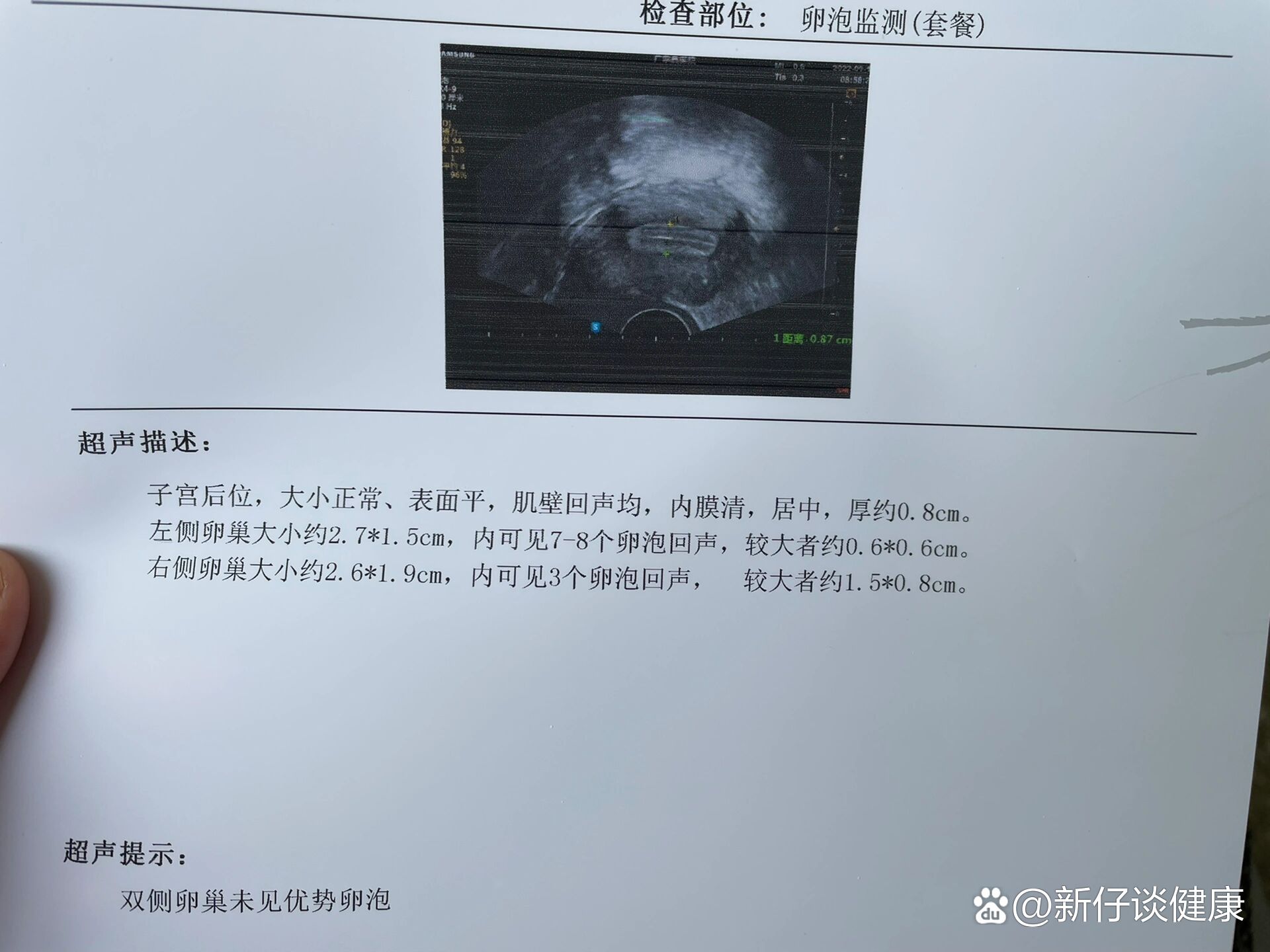 卵泡长到8mm不长是怎么回事(卵泡长到8mm再有几天能长到20)