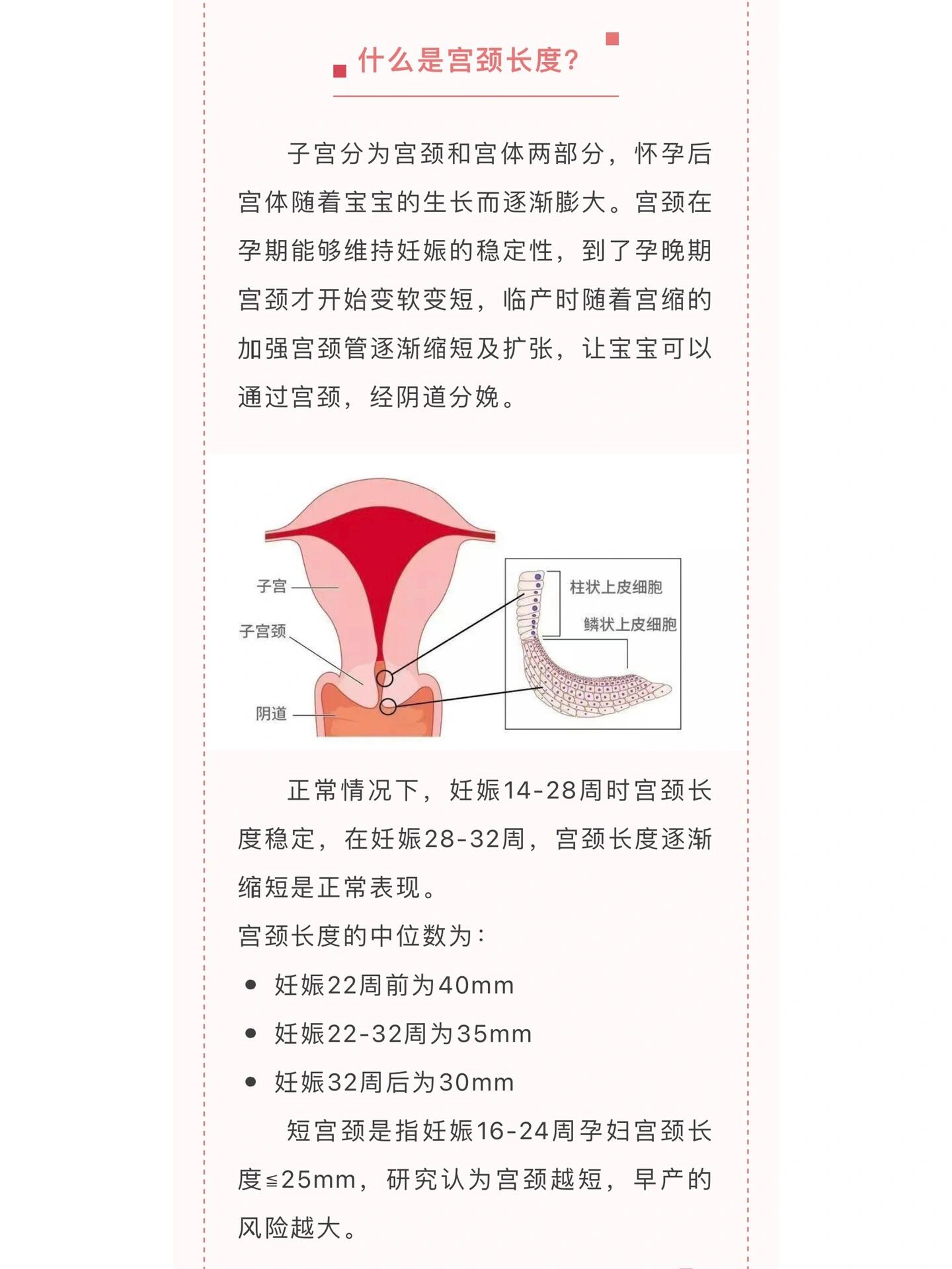 宫颈长度怎么检查图片