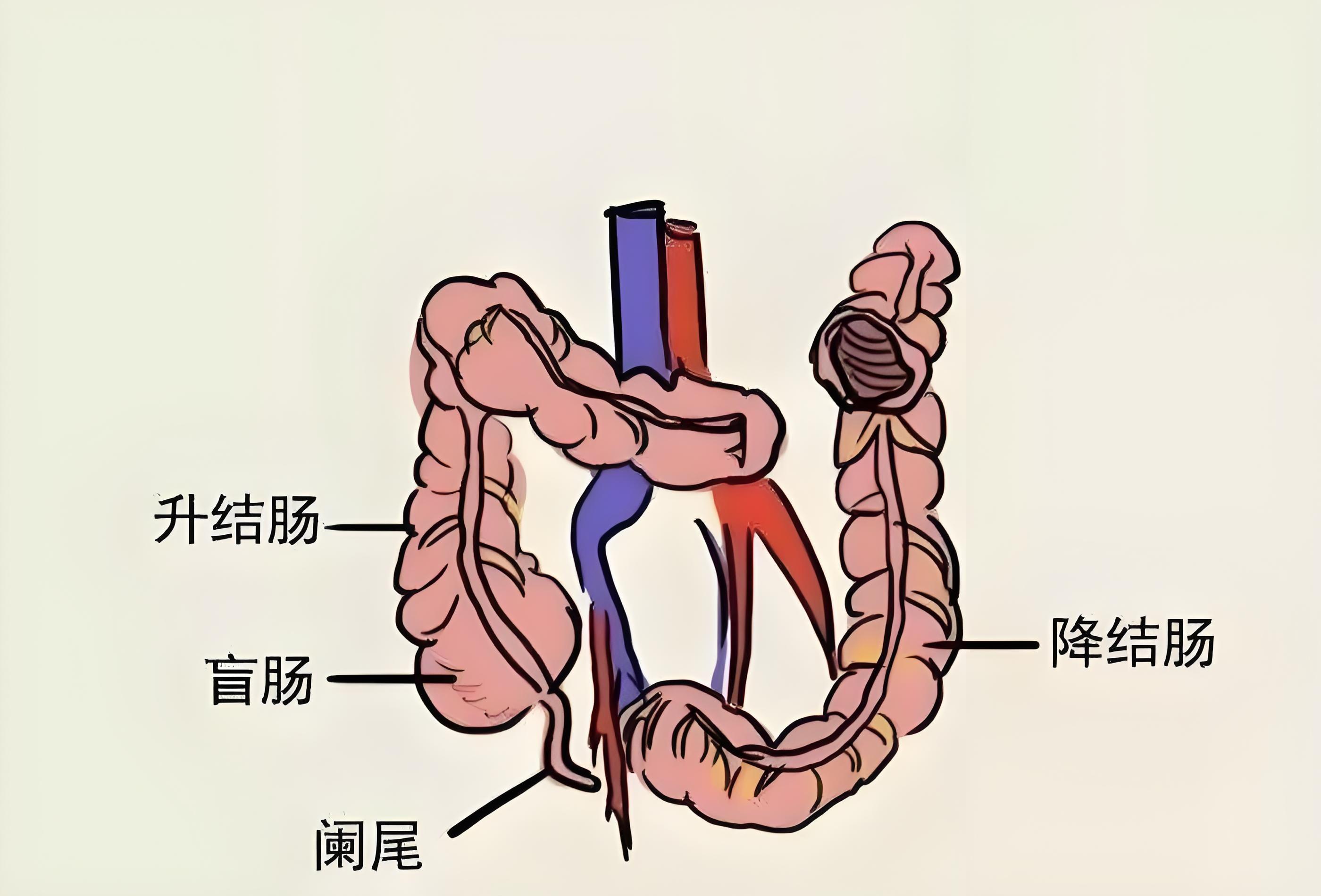 阑尾在哪个位置?