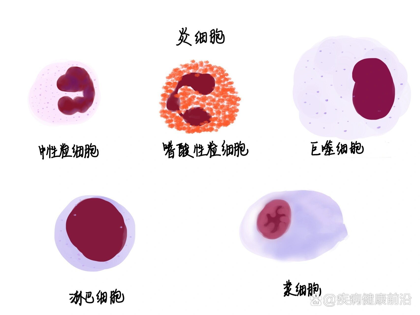 各种炎细胞图片