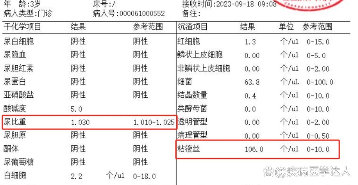 尿沉渣粘液丝图片