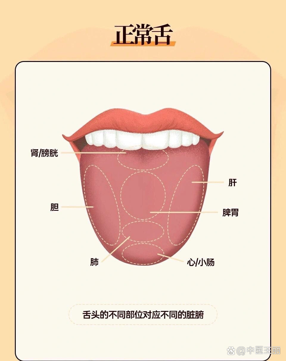 六个中医常见舌苔图,帮你快速分辨体质