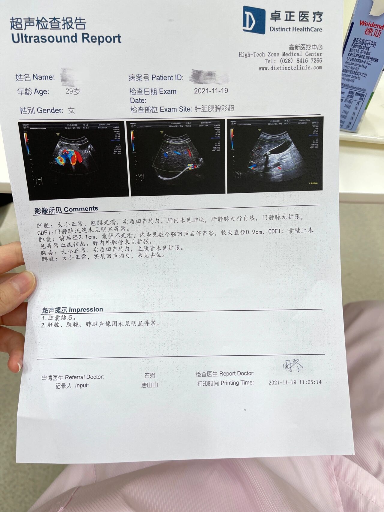 胆结石检查结果图片图片