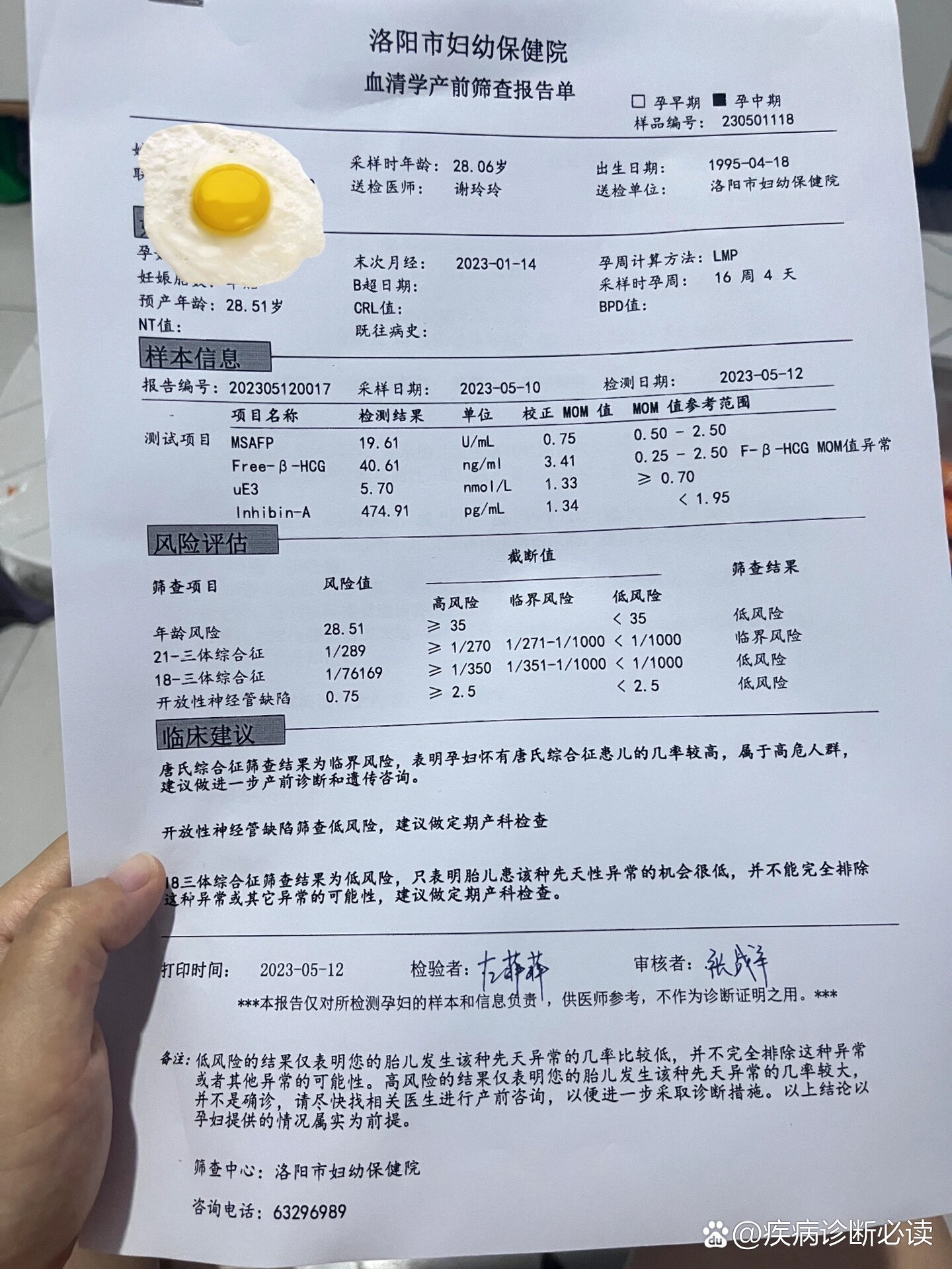 唐筛21三体临界风险