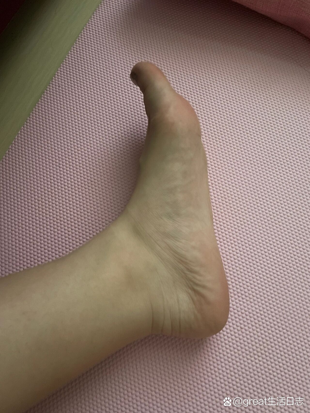  br>没有脚脖子就算了,突然发现还是扁平足 /p>