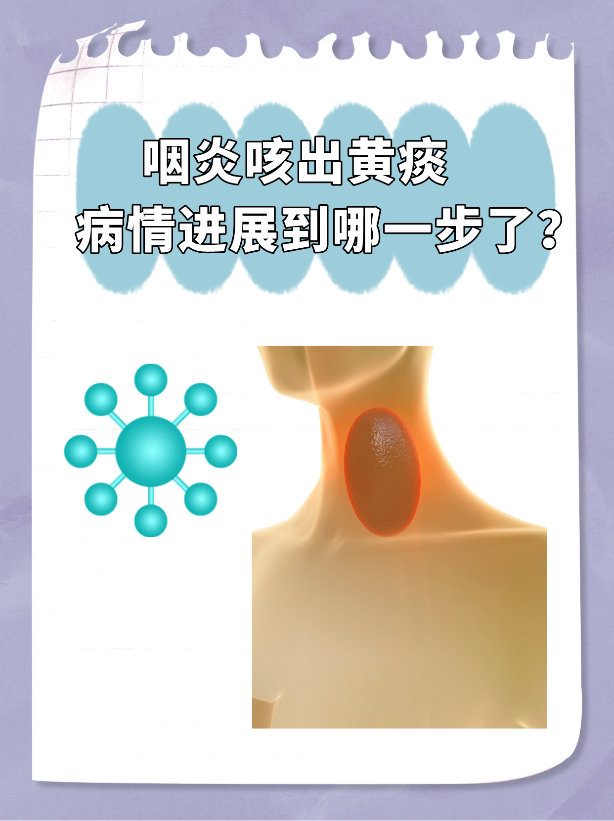 为什么喉咙有痰